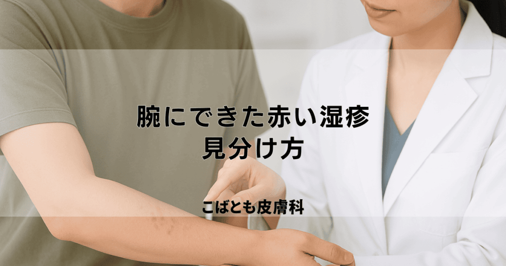 腕にできた赤い湿疹の原因とは？かぶれ・あせも・虫刺されの見分け方