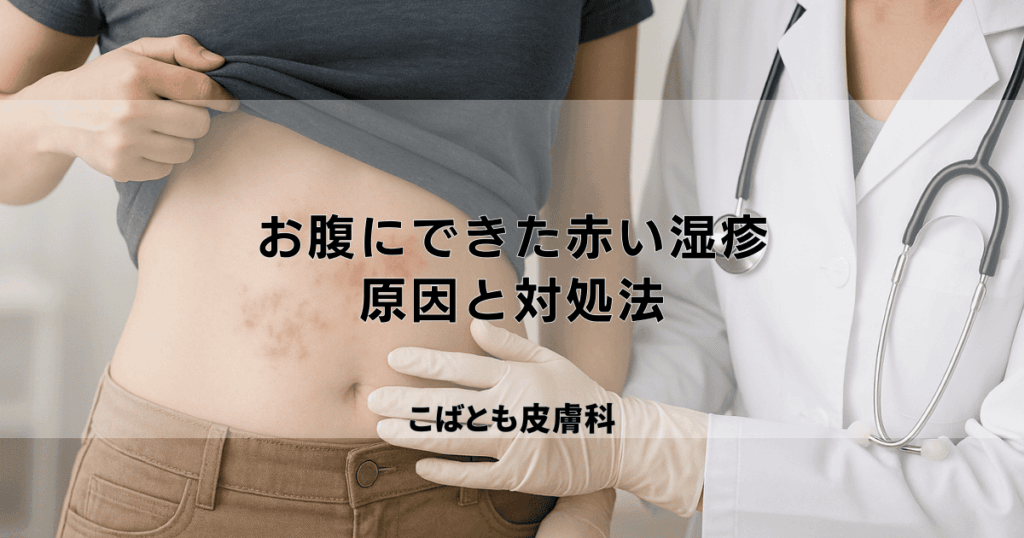 お腹にできた赤い湿疹、かゆい・かゆくない原因は？ダニやストレス？対処法を解説