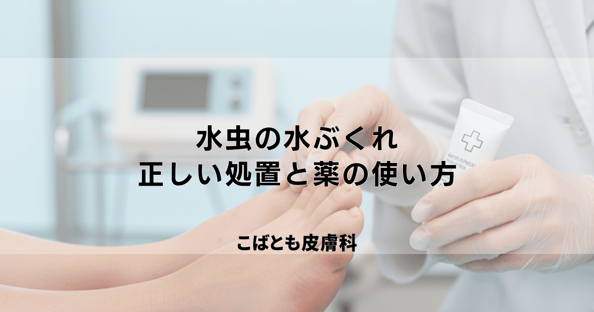 水虫の水ぶくれは潰していい？かゆい水疱の正しい処置と薬の使い方