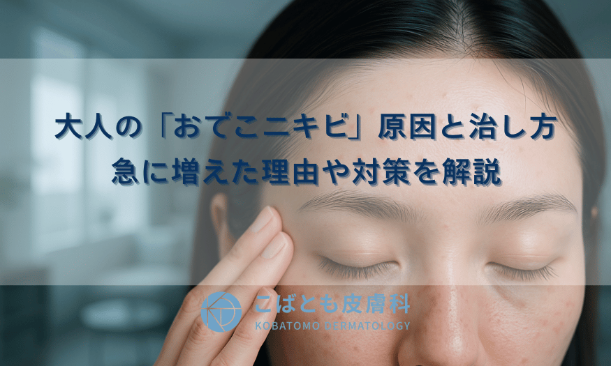 大人の「おでこニキビ」原因と治し方｜急に増えた理由や対策を解説
