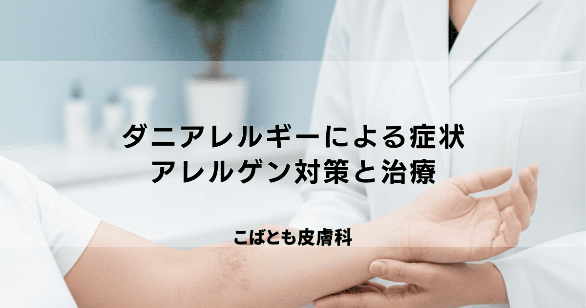 ダニアレルギーによる湿疹・蕁麻疹の症状は?アレルゲン対策と治療法