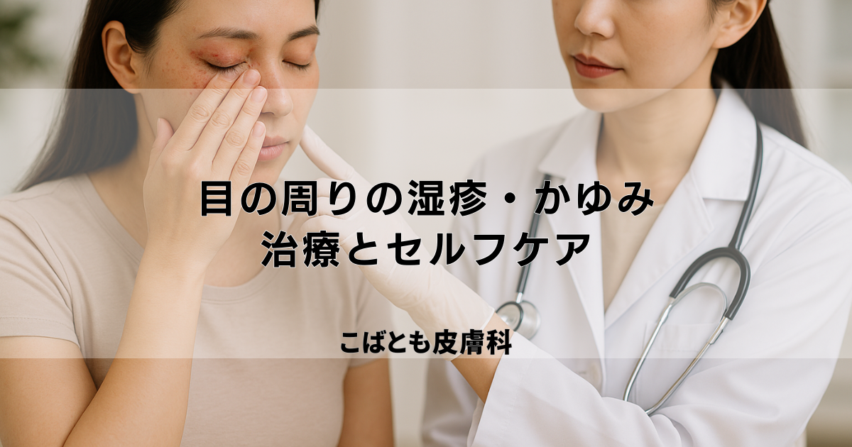 目の周りのつらい湿疹・かゆみ、どう治す？皮膚科での治療とセルフケア
