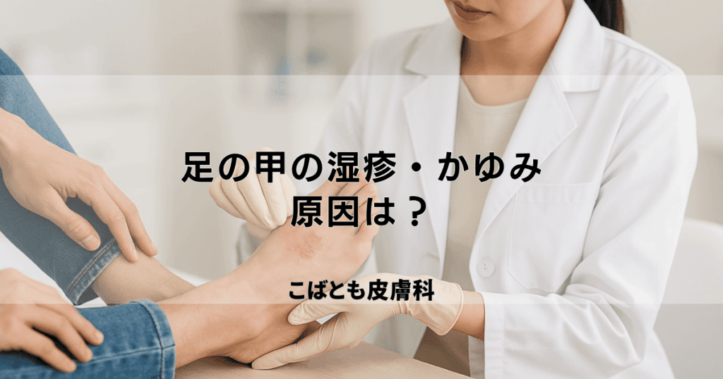 足の甲の湿疹・かゆみの原因は？サンダルのかぶれや靴擦れ、虫刺されかも