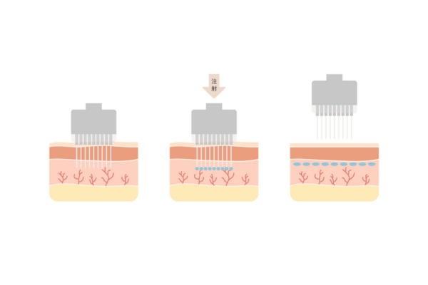 ハイコックスの特徴