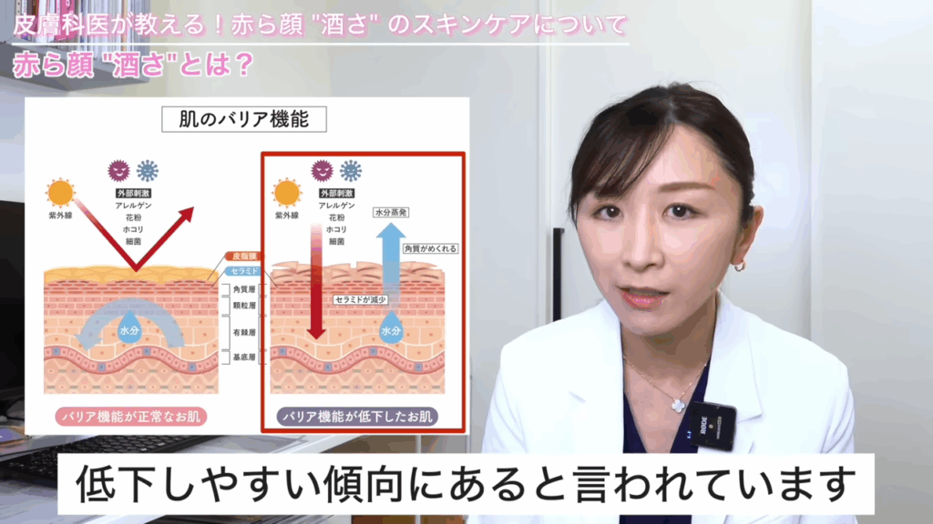 酒さでは、角層の水分量が低下しやすい傾向にある