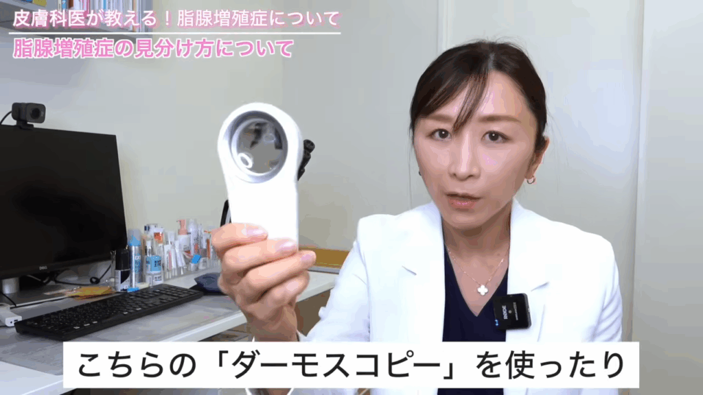 ダーモスコピー