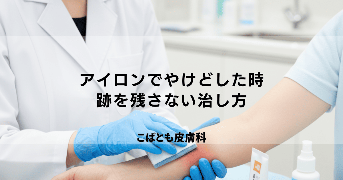 アイロンでやけどした時の応急処置｜跡を残さない正しい治し方とヒリヒリを抑える方法