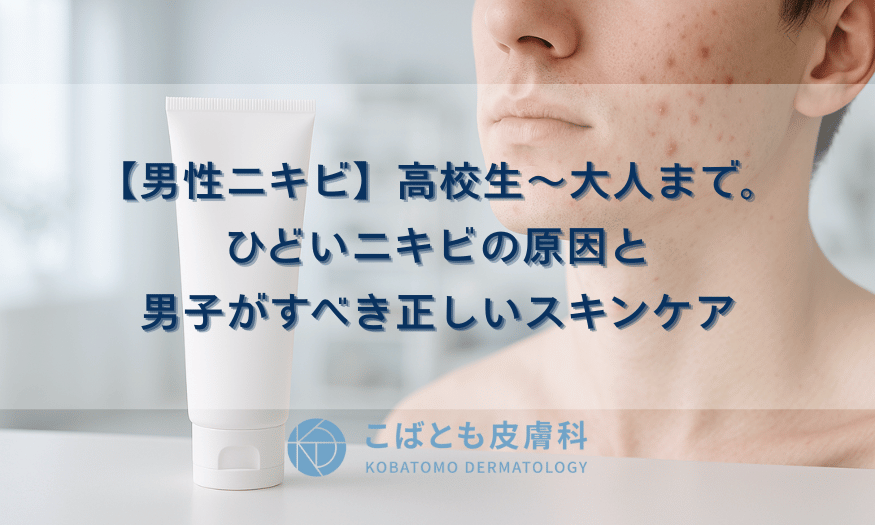 【男性ニキビ】高校生～大人まで。ひどいニキビの原因と男子がすべき正しいスキンケア