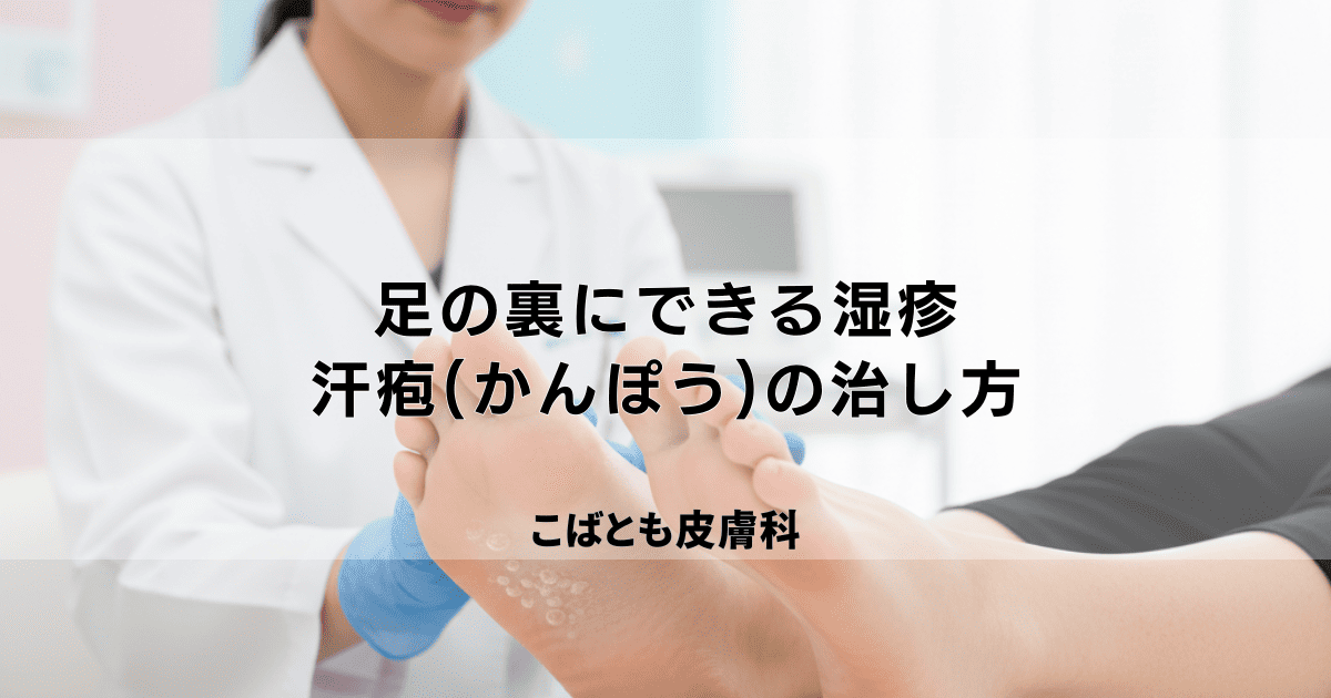 足の裏にできる湿疹の正体は?水虫と間違えやすい汗疱(かんぽう)の治し方
