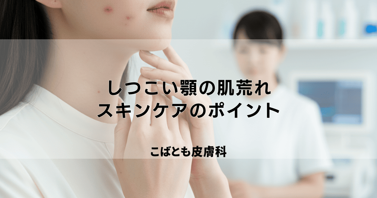 しつこい顎の肌荒れ、原因は?タイプ別の治し方とスキンケアのポイント