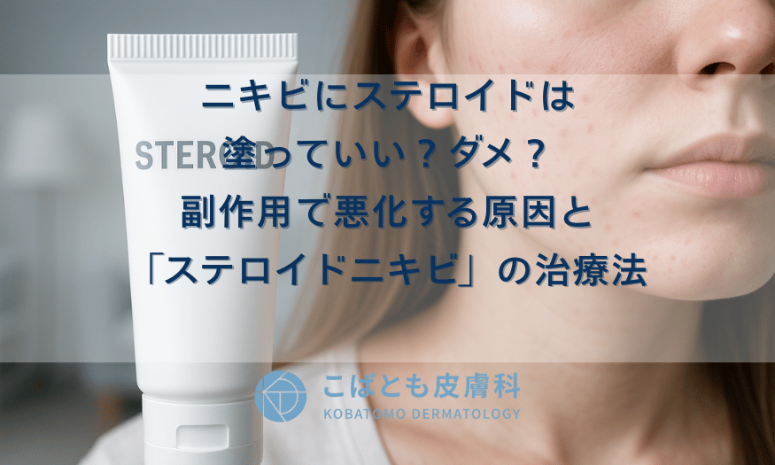 ニキビにステロイドは塗っていい？ダメ？副作用で悪化する原因と「ステロイドニキビ」の治療法