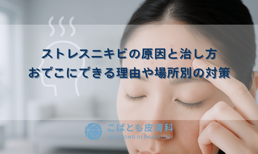 ストレスニキビの原因と治し方｜おでこにできる理由や場所別の対策