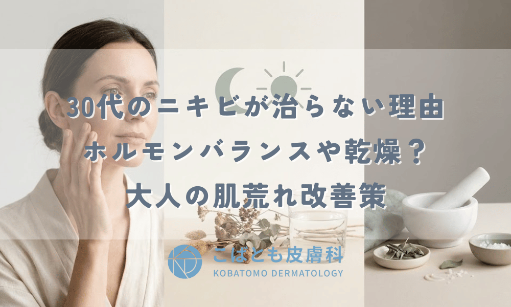 30代のニキビが治らない理由｜ホルモンバランスや乾燥？大人の肌荒れ改善策
