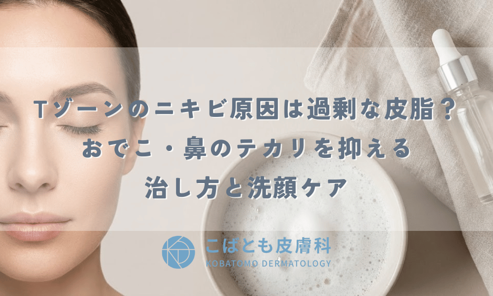 Tゾーンのニキビ原因は過剰な皮脂？おでこ・鼻のテカリを抑える治し方と洗顔ケア
