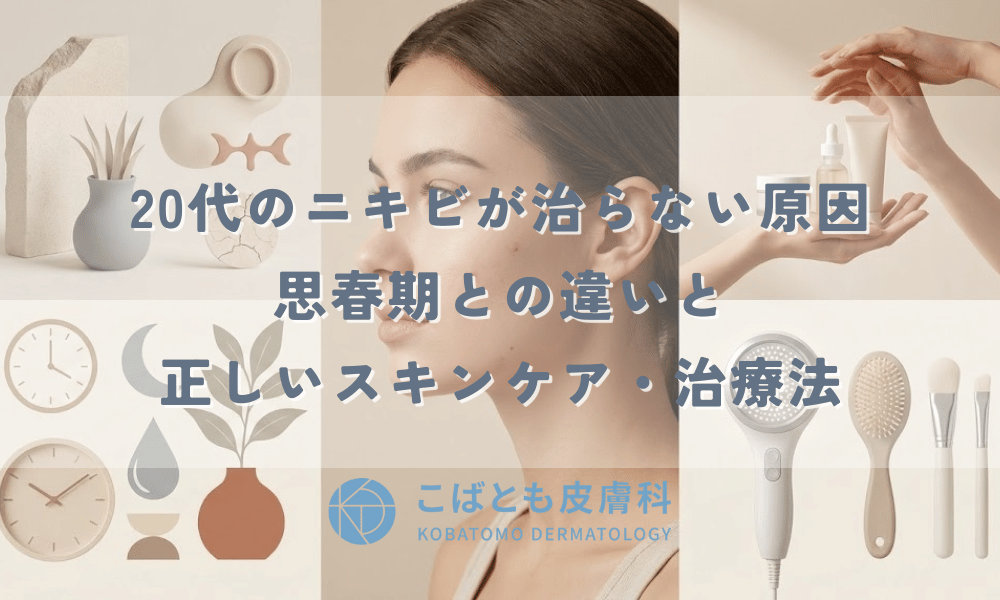 20代のニキビが治らない原因とは？思春期との違いと正しいスキンケア・治療法
