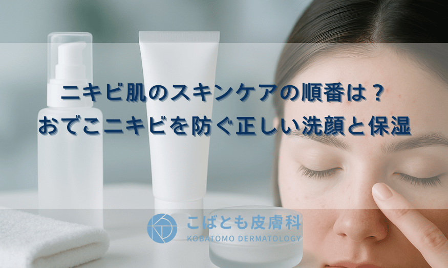ニキビ肌のスキンケアの順番は？おでこニキビを防ぐ正しい洗顔と保湿