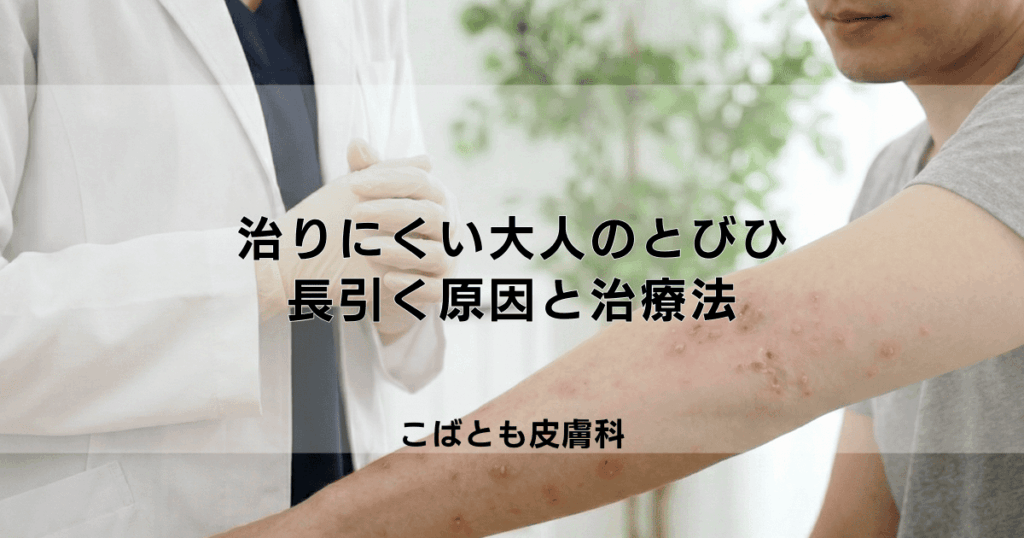 なぜ大人のとびひは治りにくい？長引く原因と正しい治療法を解説