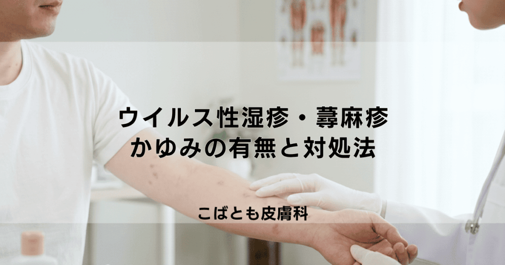 大人のウイルス性湿疹・蕁麻疹の原因は？かゆみの有無と症状別の対処法