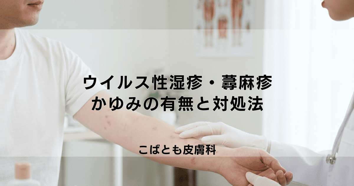 大人のウイルス性湿疹・蕁麻疹の原因は？かゆみの有無と症状別の対処法