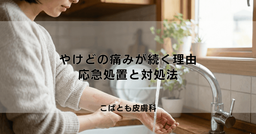 やけどのヒリヒリする痛みが続くのはなぜ？痛みを和らげる応急処置と対処法