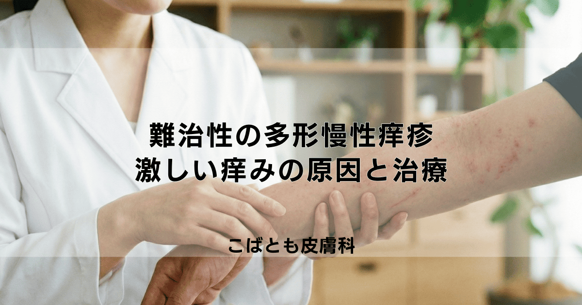 治りにくい多形慢性痒疹とは？激しいかゆみの原因と治療法を解説
