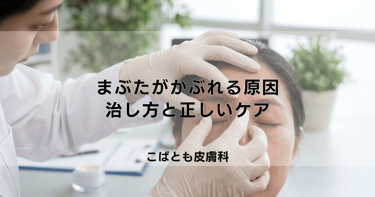 まぶたがかぶれる原因は化粧品?かゆみ・赤みの治し方と正しいケア