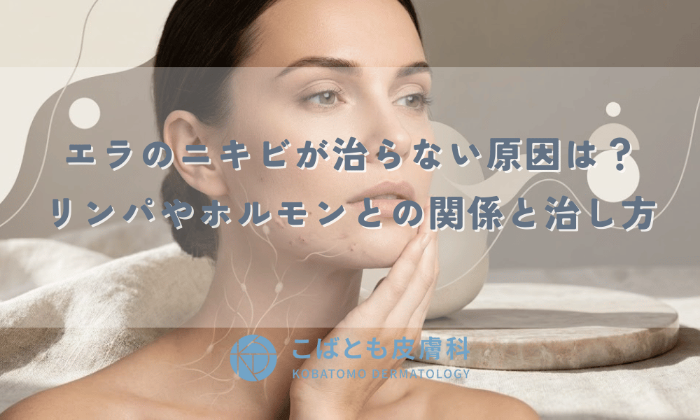 エラ（フェイスライン）のニキビが治らない原因は？リンパやホルモンとの関係と治し方