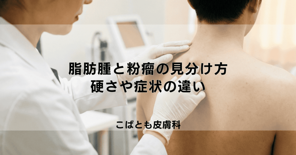 「脂肪腫」と「粉瘤（ふんりゅう）」の見分け方｜しこりの硬さや症状の違い