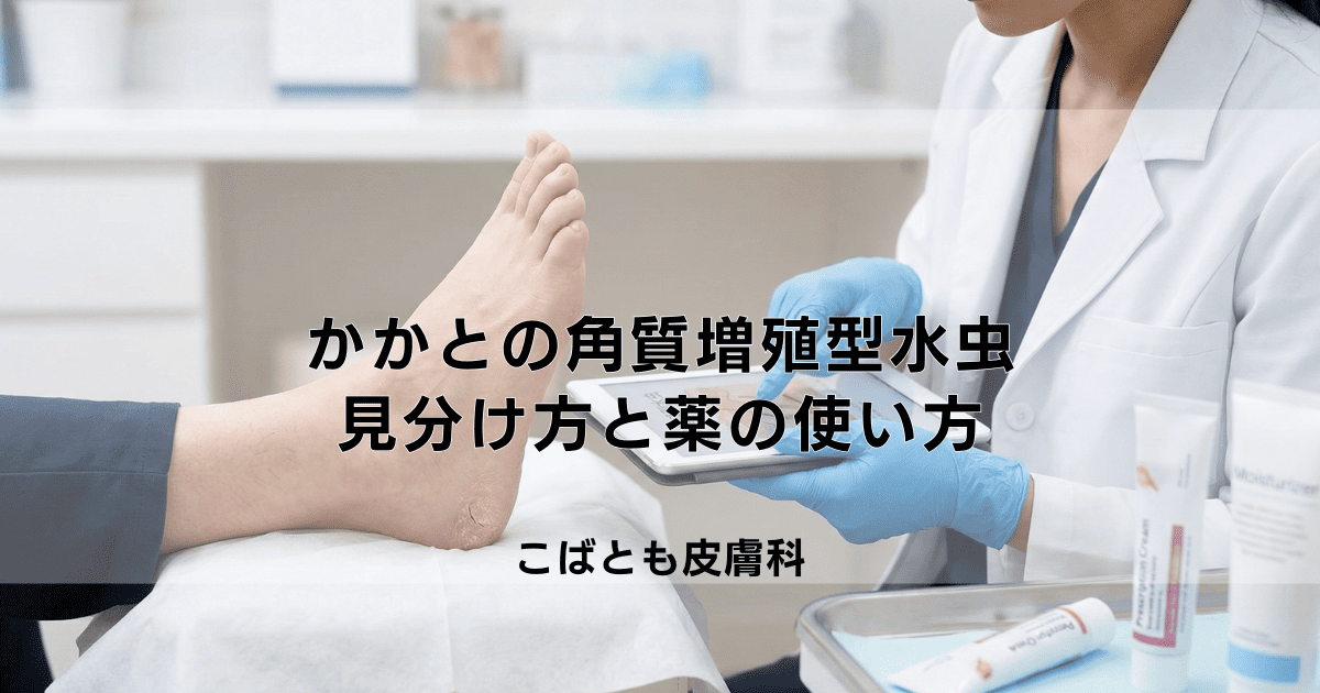 かかとがガサガサになる角質増殖型水虫の見分け方と効果的な薬の使い方