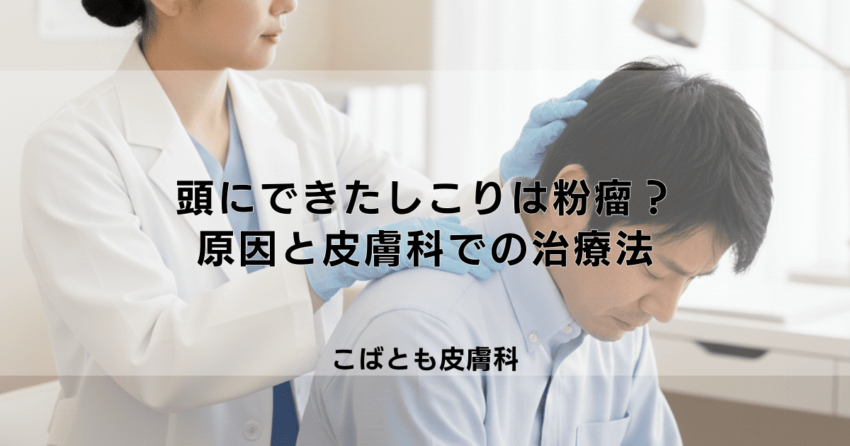 頭にできた痛い「しこり」は粉瘤かも？原因と皮膚科での手術・治療法