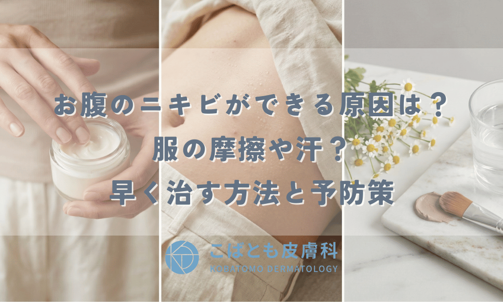 お腹のニキビができる原因は？服の摩擦や汗？早く治す方法と予防策