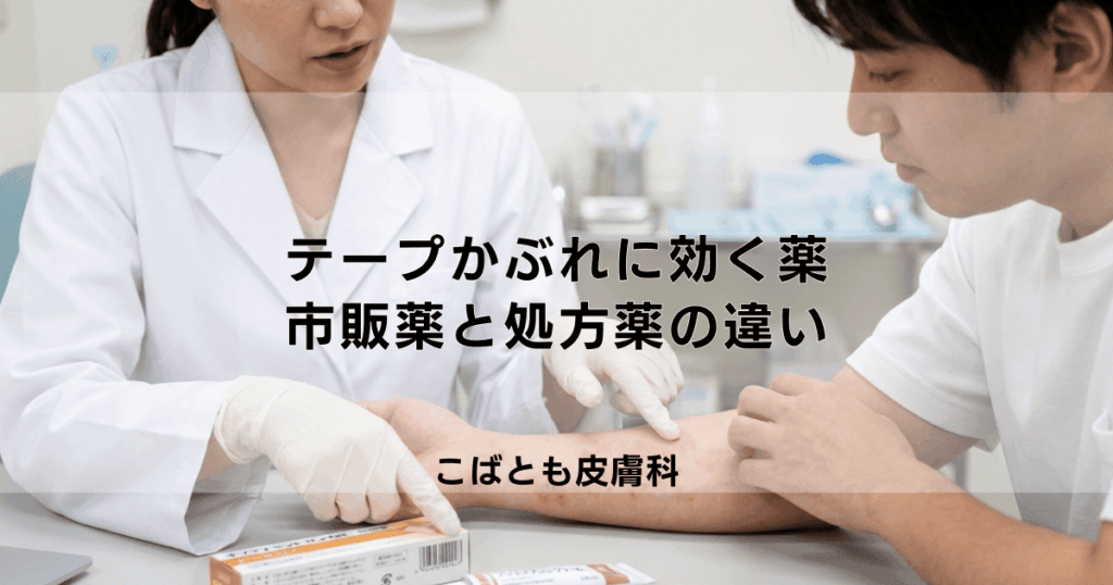 テープかぶれのかゆみと赤みに効く薬は？市販薬と皮膚科で処方される軟膏の違い