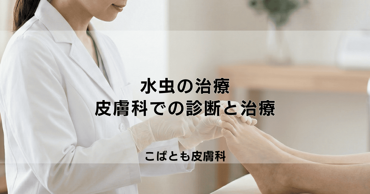 水虫の治療は何科へ行くべき？皮膚科での診断と正しい治療の始め方