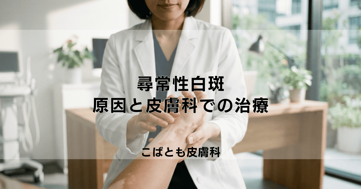尋常性白斑の原因と皮膚科での治療法について