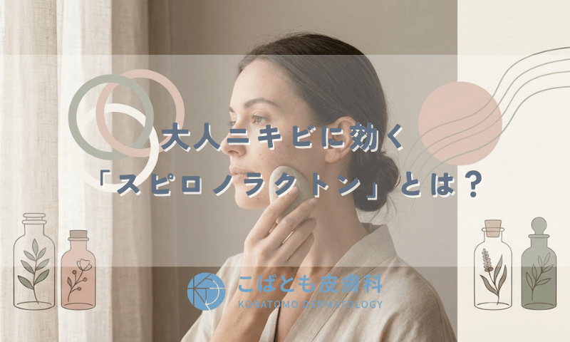 大人ニキビに効く「スピロノラクトン」とは？ホルモン治療の効果と対象者