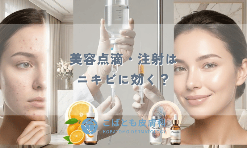 美容点滴・注射はニキビに効く？高濃度ビタミンCやプラセンタの効果とは
