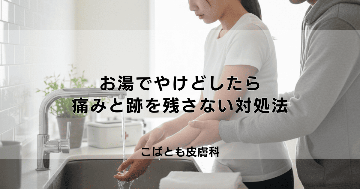 お湯でやけどした時の応急処置｜すぐに痛みを和らげ跡を残さないための対処法