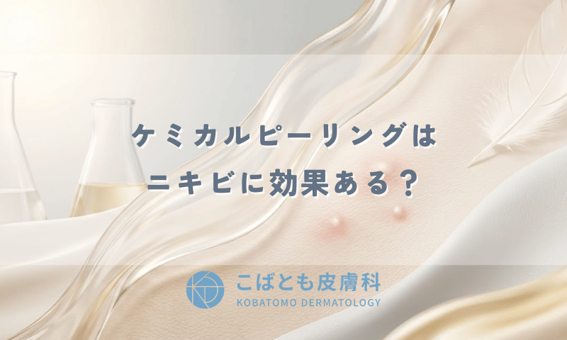 ケミカルピーリングはニキビに効果ある？回数の目安とピリピリする痛みについて