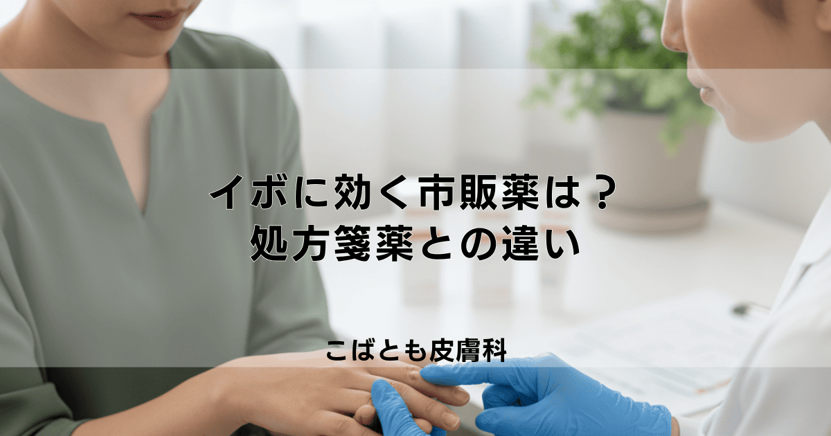 イボに効く塗り薬は市販で買える？皮膚科で処方される薬の種類と効果