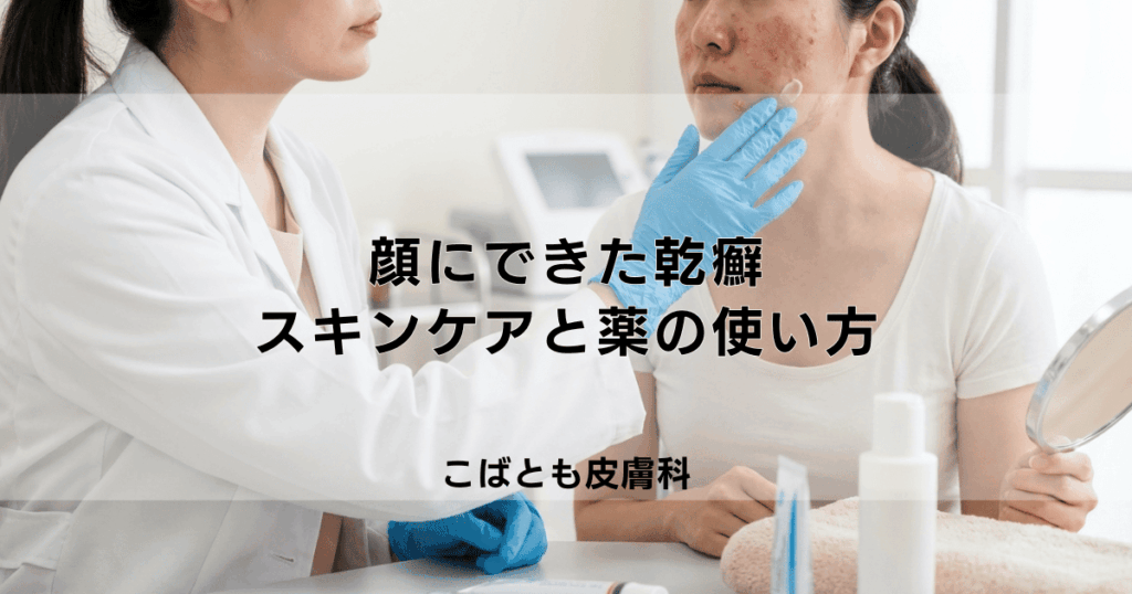 顔にできた乾癬の治療法｜デリケートな肌への正しいスキンケアと薬の使い方