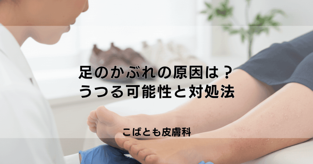 足のかぶれ、その原因は？靴や植物？うつる可能性と正しい対処法