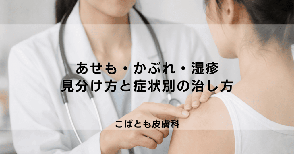 あせも・かぶれ・湿疹の違いとは？見分け方と症状別の正しい治し方