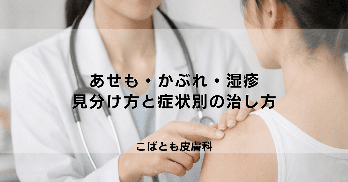 あせも・かぶれ・湿疹の違いとは?見分け方と症状別の正しい治し方