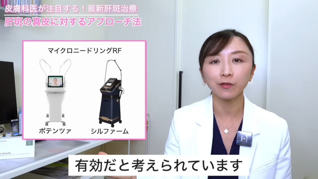 肝斑の真皮に対するアプローチ法（ポテンツァ・シルファームなどのマイクロニードリングRF）