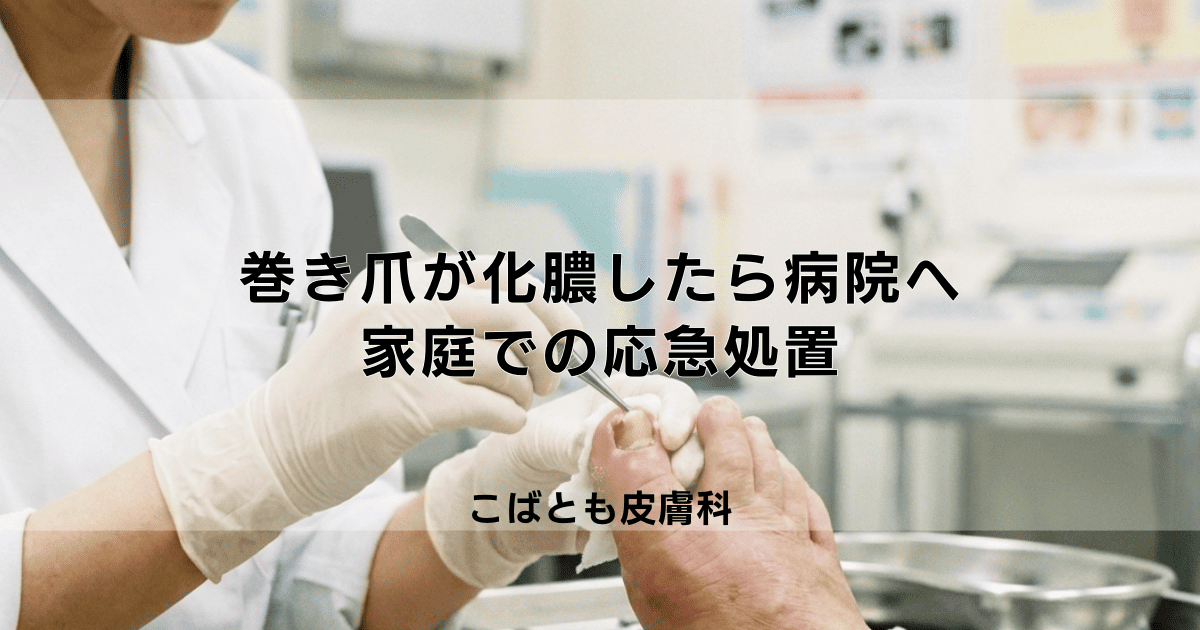 巻き爪が化膿して膿が出たらすぐに病院へ!家庭での応急処置と治療法
