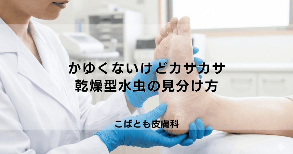 かゆくないけどカサカサ…それも水虫かも？乾燥型水虫の見分け方と治し方