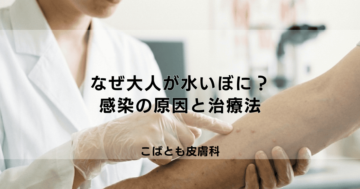 「なぜ大人が水いぼに?考えられる感染の原因と治療法について
