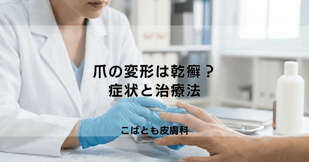 爪の変形は乾癬が原因かも?爪乾癬の症状と皮膚科での治療法