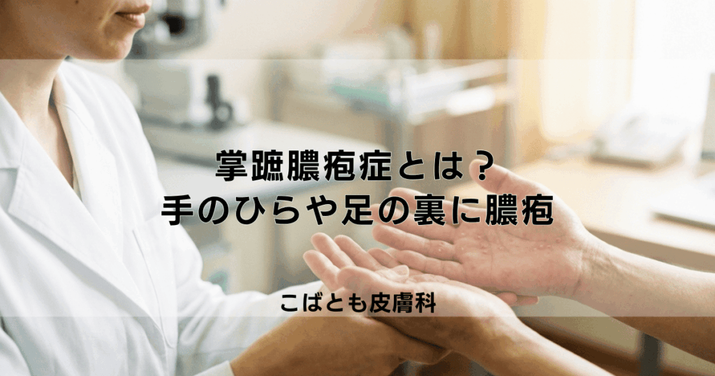 「掌蹠膿疱症（しょうせきのうほうしょう）」とは？手のひらや足の裏に膿疱ができる病気を解説