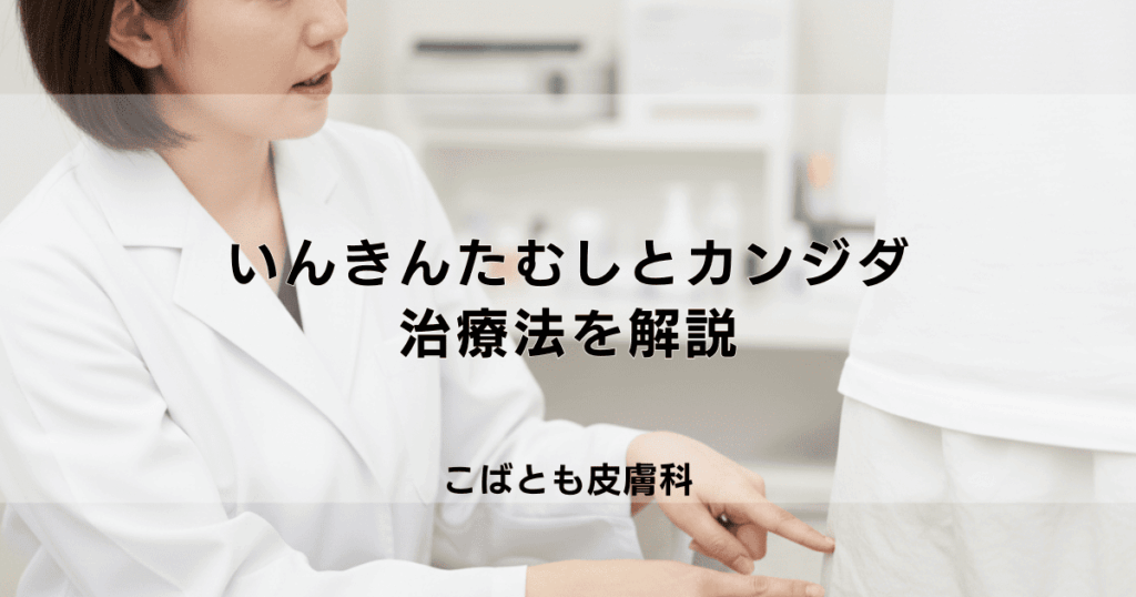 いんきんたむしとカンジダの違いは？皮膚科受診をためらわないで！治療法を解説